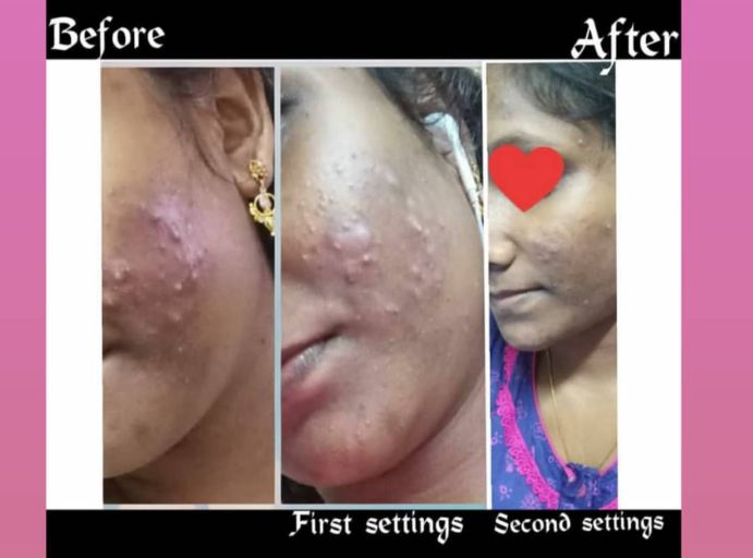 Gallery Sv Makeover Portfolio11